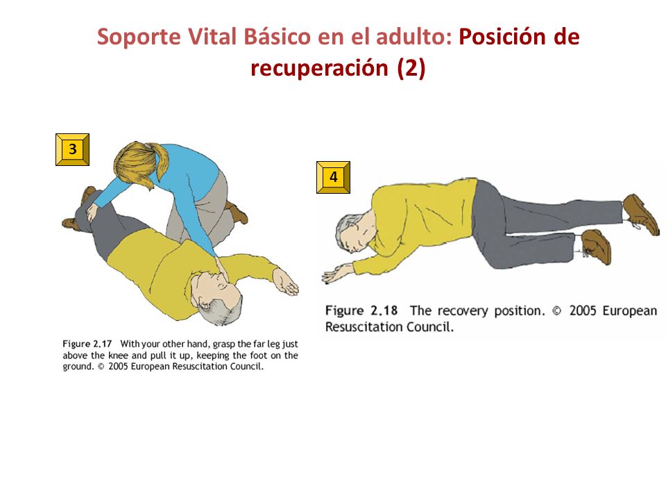 Soporte Vital Básico en el adulto: Posición de recuperación (2)