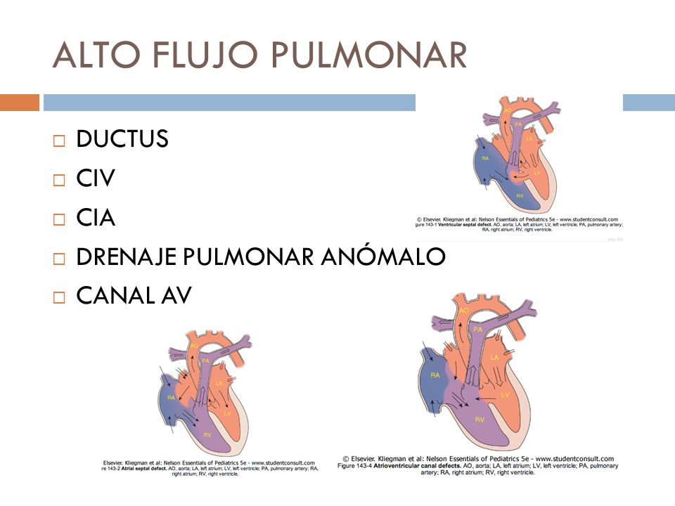 ALTO FLUJO PULMONAR DUCTUS CIV CIA DRENAJE PULMONAR ANÓMALO CANAL AV