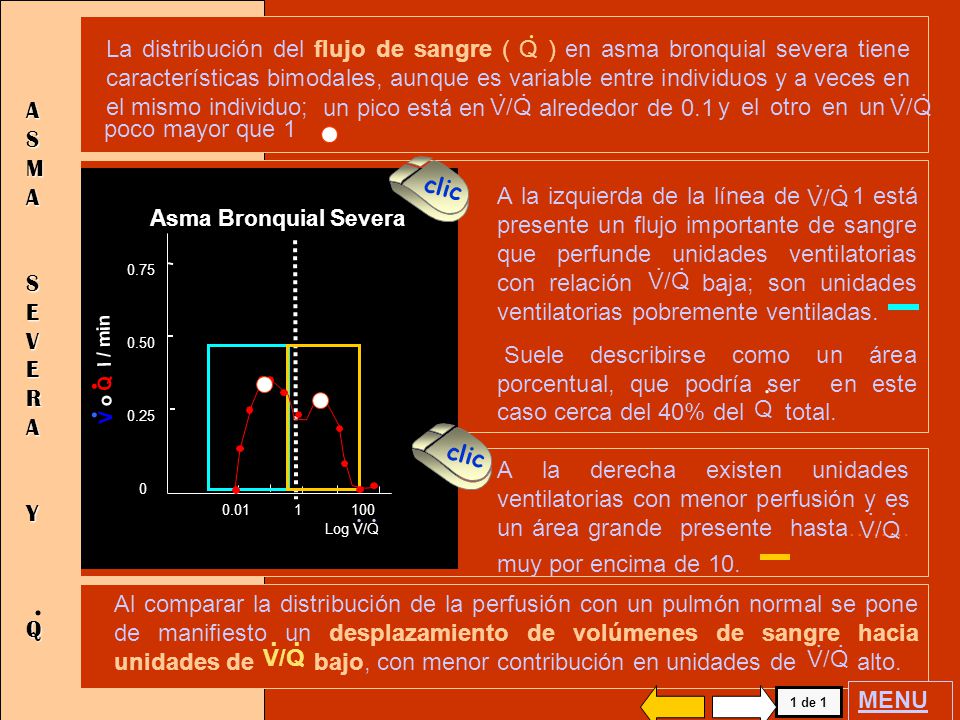 La distribución del flujo de sangre ( Q ) en asma bronquial severa tiene características bimodales, aunque es variable entre individuos y a veces en el mismo individuo;