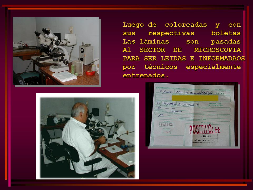 Luego de coloreadas y con