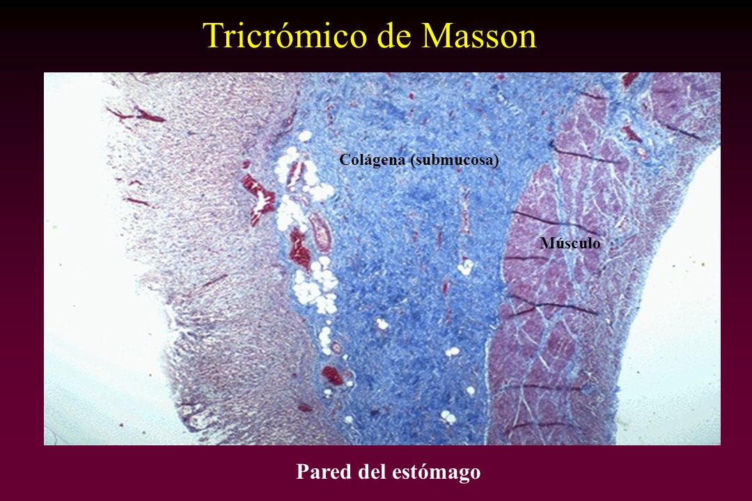 Tricrómico de Masson Colágena (submucosa) Músculo Pared del estómago
