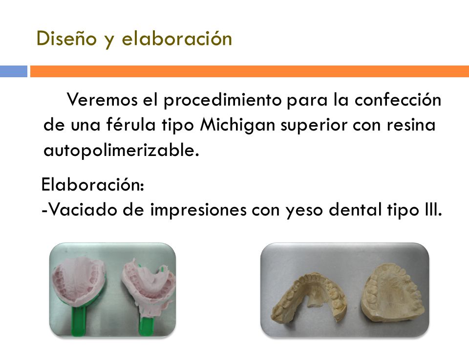 Diseño y elaboración Veremos el procedimiento para la confección