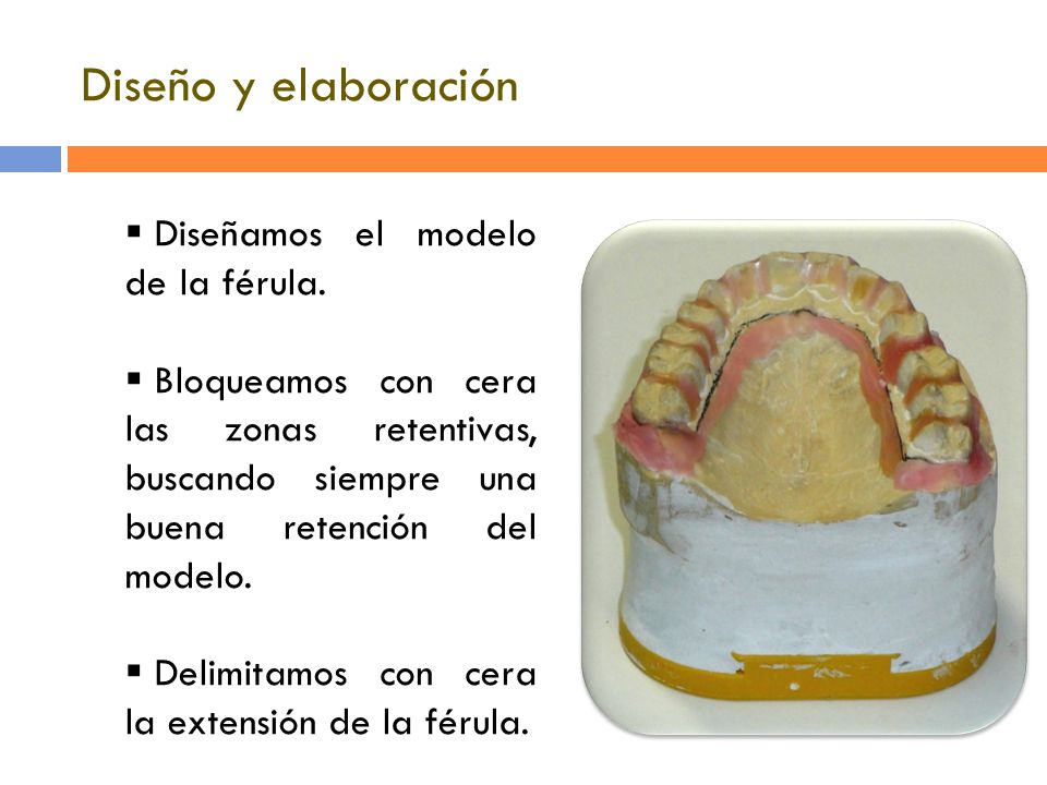 Diseño y elaboración Diseñamos el modelo de la férula.