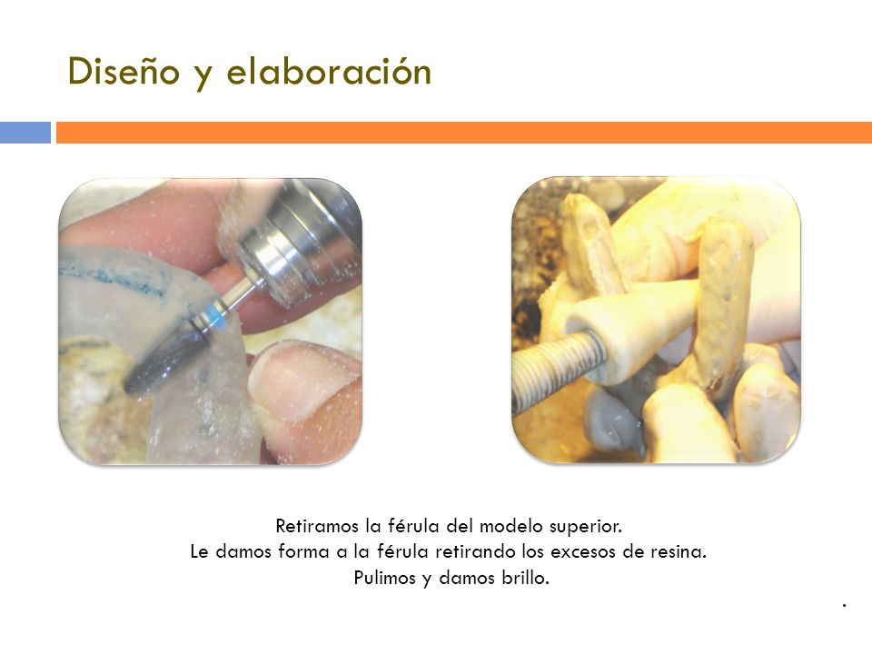 Diseño y elaboración Retiramos la férula del modelo superior.