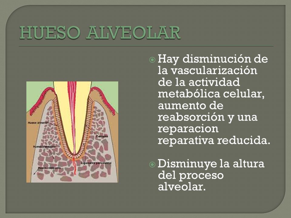 HUESO ALVEOLAR Hay disminución de la vascularización de la actividad metabólica celular, aumento de reabsorción y una reparacion reparativa reducida.