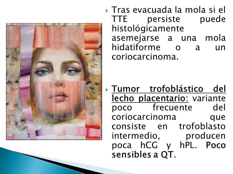 Tras evacuada la mola si el TTE persiste puede histológicamente asemejarse a una mola hidatiforme o a un coriocarcinoma.