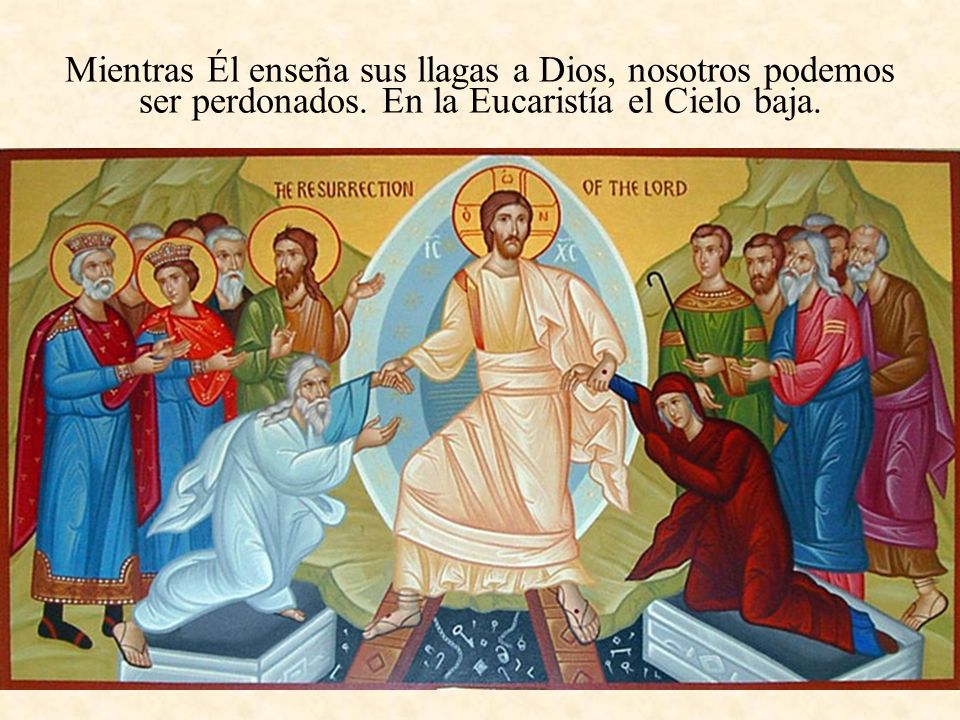 Mientras Él enseña sus llagas a Dios, nosotros podemos ser perdonados