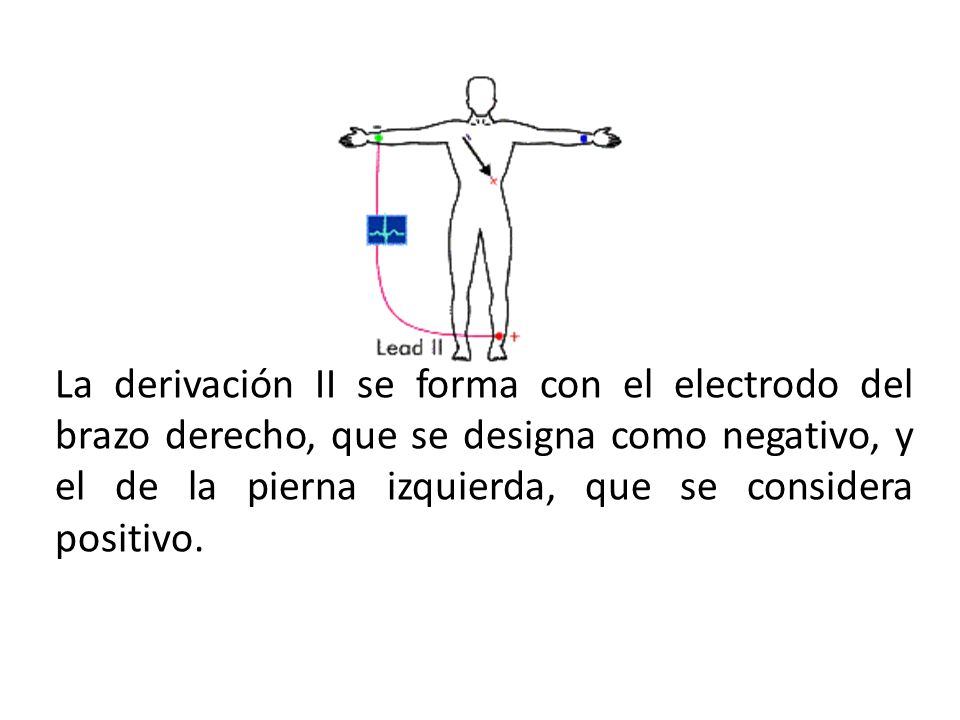 La derivación II se forma con el electrodo del brazo derecho, que se designa como negativo, y el de la pierna izquierda, que se considera positivo.