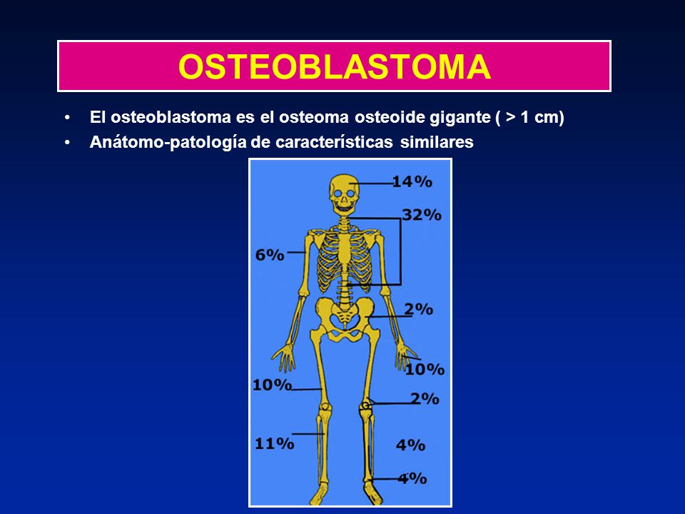 OSTEOBLASTOMA El osteoblastoma es el osteoma osteoide gigante ( > 1 cm) Anátomo-patología de características similares.