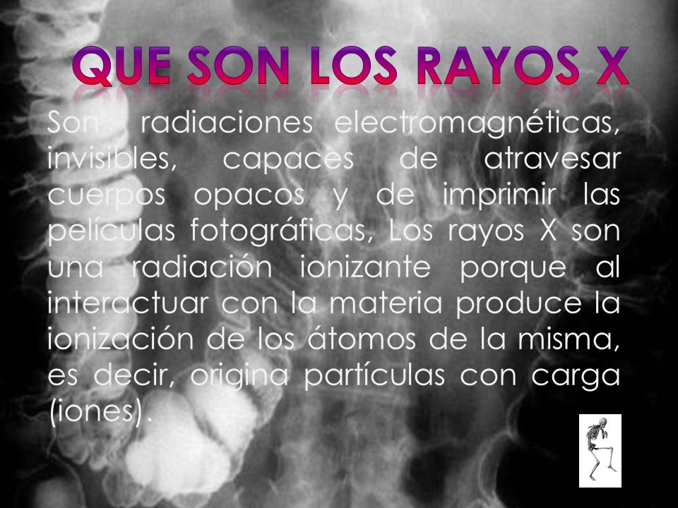 QUE son los Rayos X