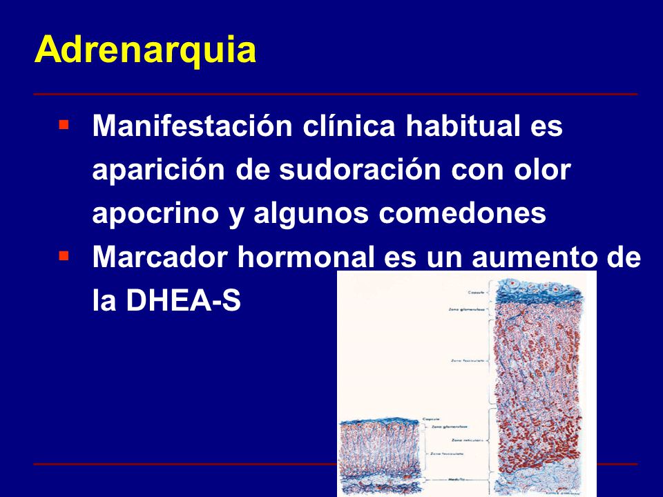 Adrenarquia Manifestación clínica habitual es aparición de sudoración con olor apocrino y algunos comedones.