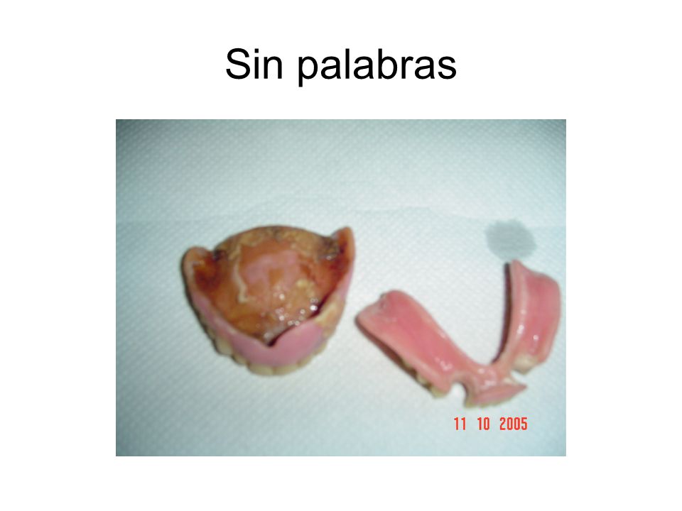 Sin palabras