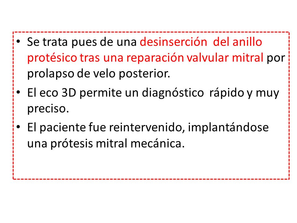 Se trata pues de una desinserción del anillo protésico tras una reparación valvular mitral por prolapso de velo posterior.