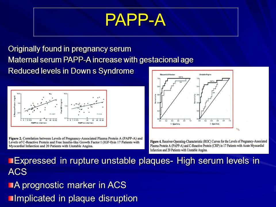 PAPP-A Expressed in rupture unstable plaques- High serum levels in ACS