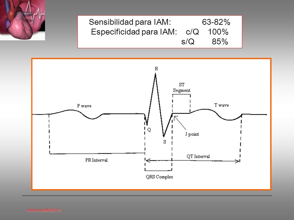 Sensibilidad para IAM: 63-82% Especificidad para IAM: c/Q 100% s/Q 85%
