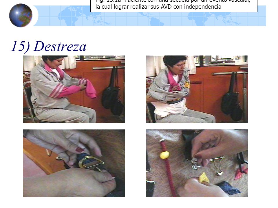 Fig. 15.1a Paciente con una secuela por un evento vascular, la cual lograr realizar sus AVD con independencia