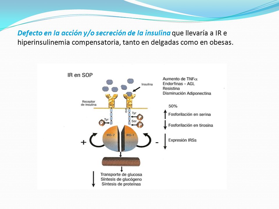 Defecto en la acción y/o secreción de la insulina que llevaría a IR e hiperinsulinemia compensatoria, tanto en delgadas como en obesas.
