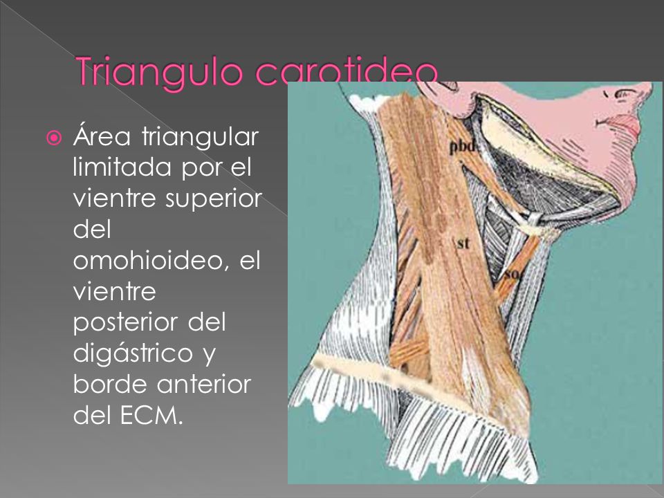 Triangulo carotideo Área triangular limitada por el vientre superior del omohioideo, el vientre posterior del digástrico y borde anterior del ECM.