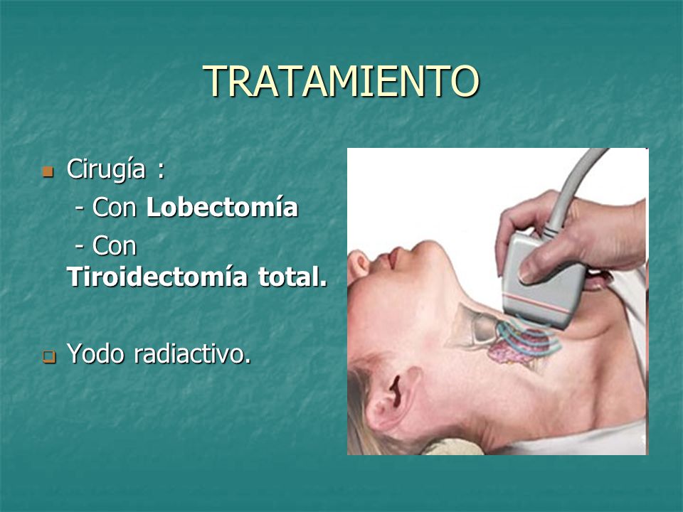 TRATAMIENTO Cirugía : - Con Lobectomía - Con Tiroidectomía total.