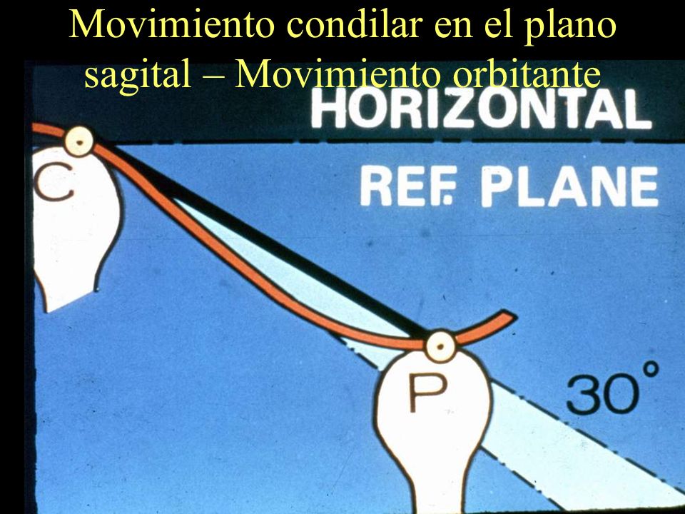 Movimiento condilar en el plano sagital – Movimiento orbitante