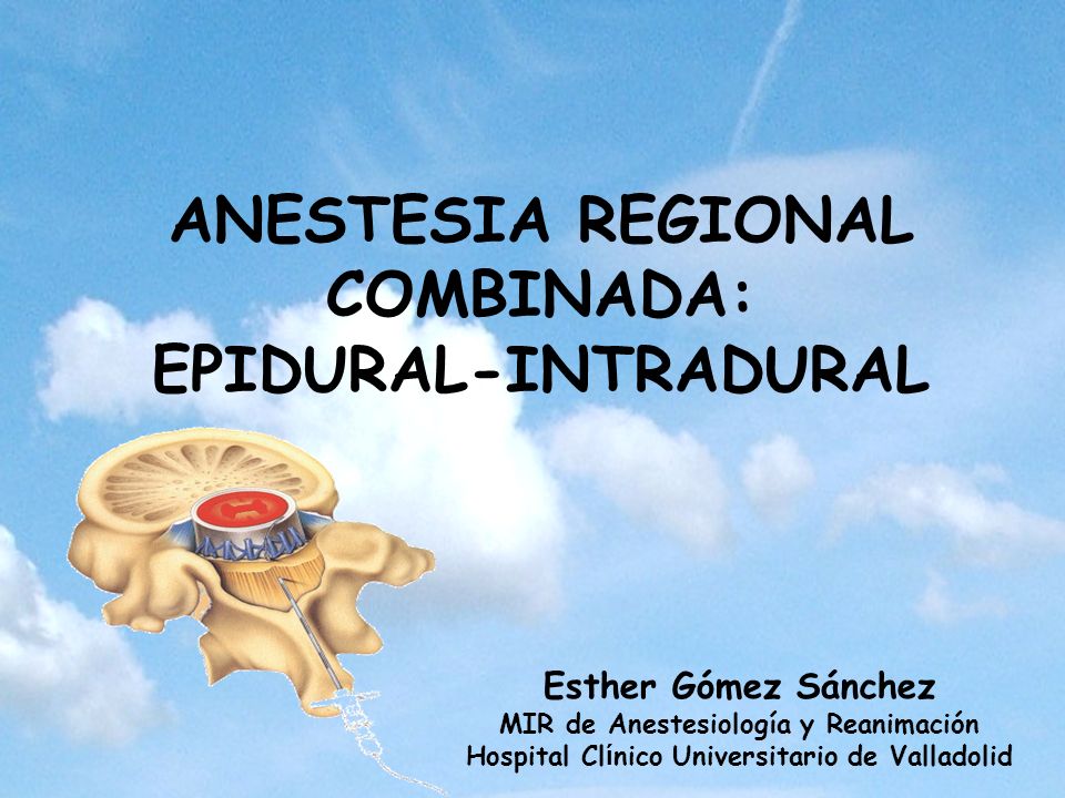ANESTESIA REGIONAL COMBINADA: EPIDURAL-INTRADURAL