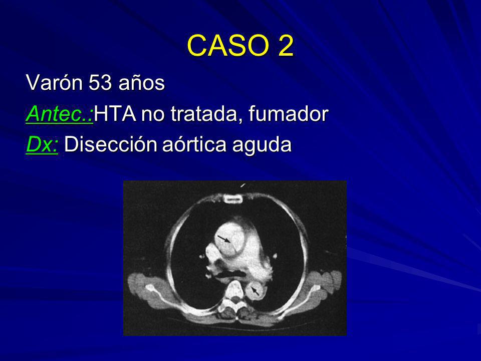CASO 2 Varón 53 años Antec.:HTA no tratada, fumador