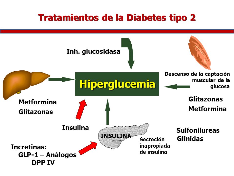 Tratamientos de la Diabetes tipo 2