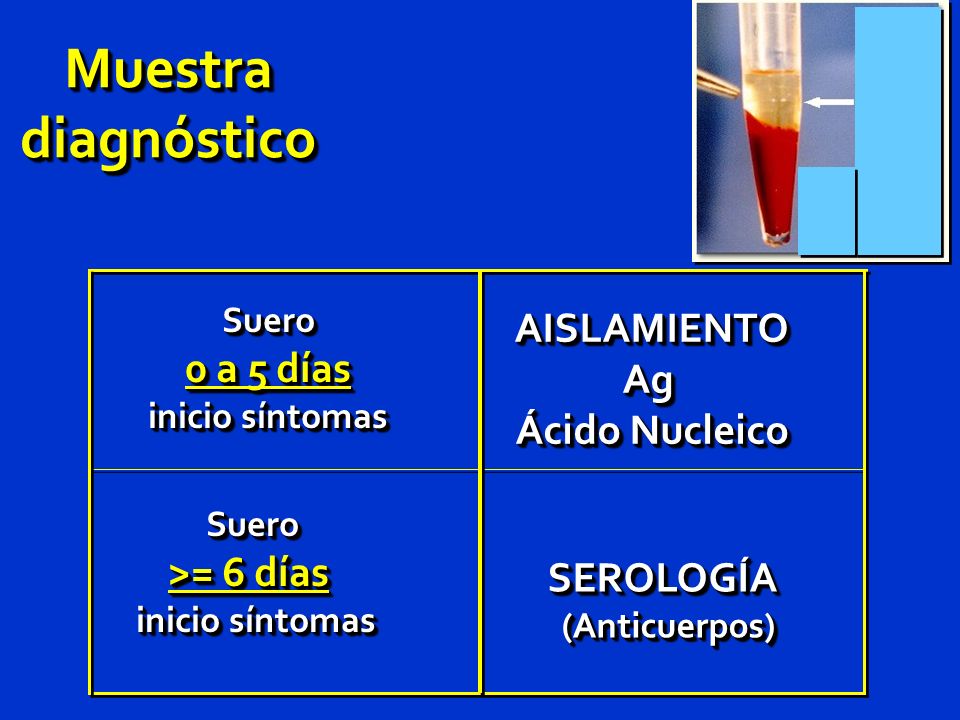Muestra diagnóstico AISLAMIENTO 0 a 5 días Ag Ácido Nucleico