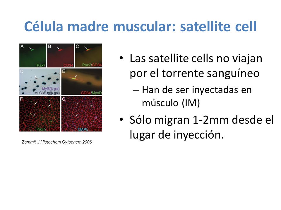 Célula madre muscular: satellite cell