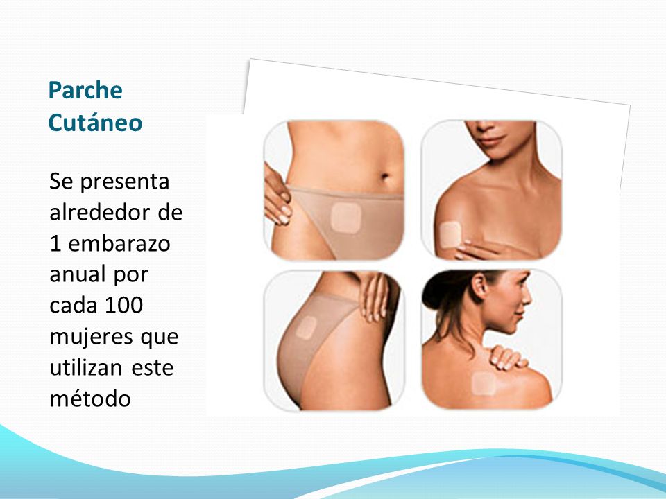 Parche Cutáneo Se presenta alrededor de 1 embarazo anual por cada 100 mujeres que utilizan este método.