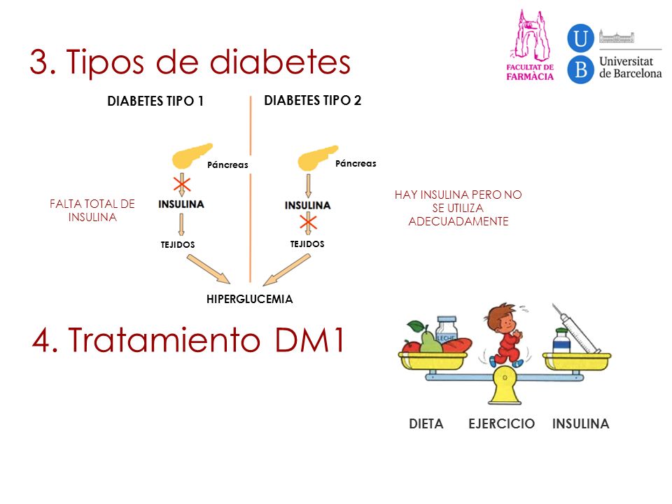 3. Tipos de diabetes 4. Tratamiento DM1 DIABETES TIPO 1