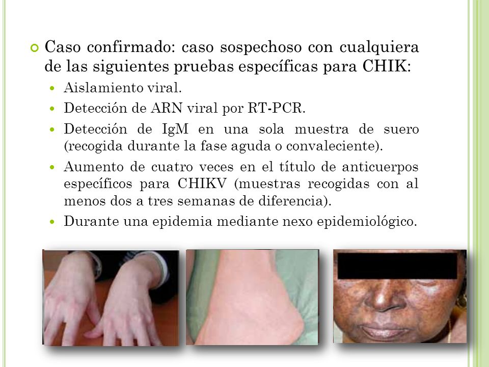 Caso confirmado: caso sospechoso con cualquiera de las siguientes pruebas específicas para CHIK: