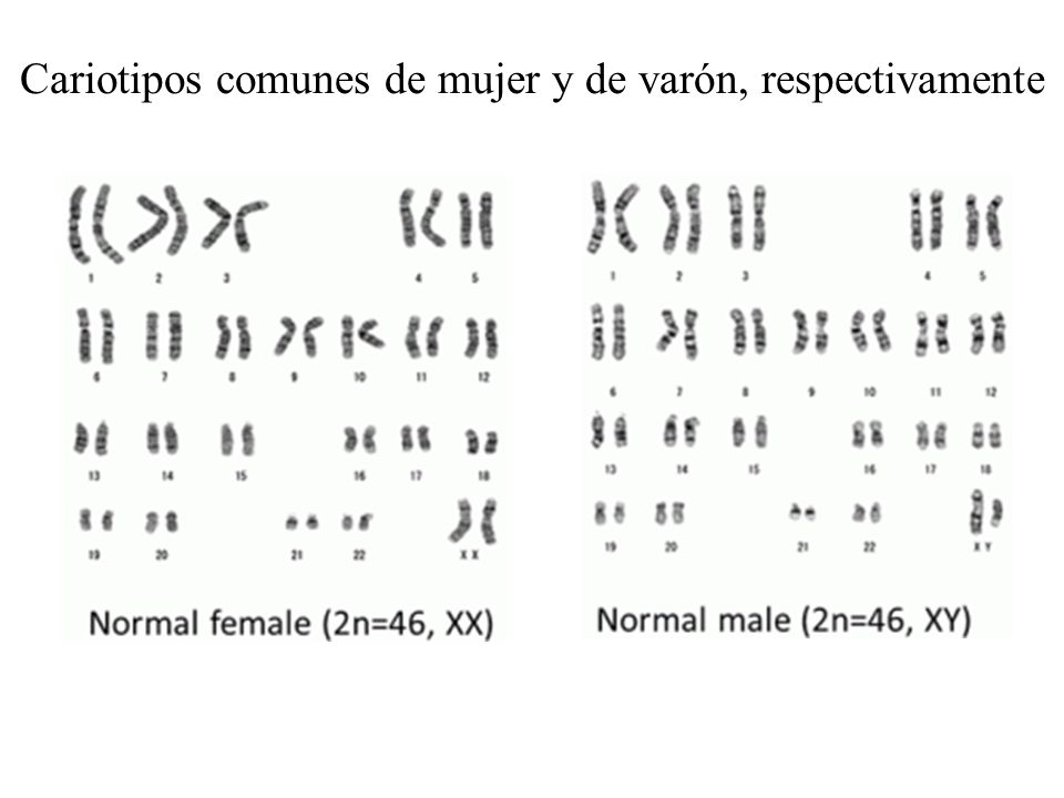 Cariotipos comunes de mujer y de varón, respectivamente