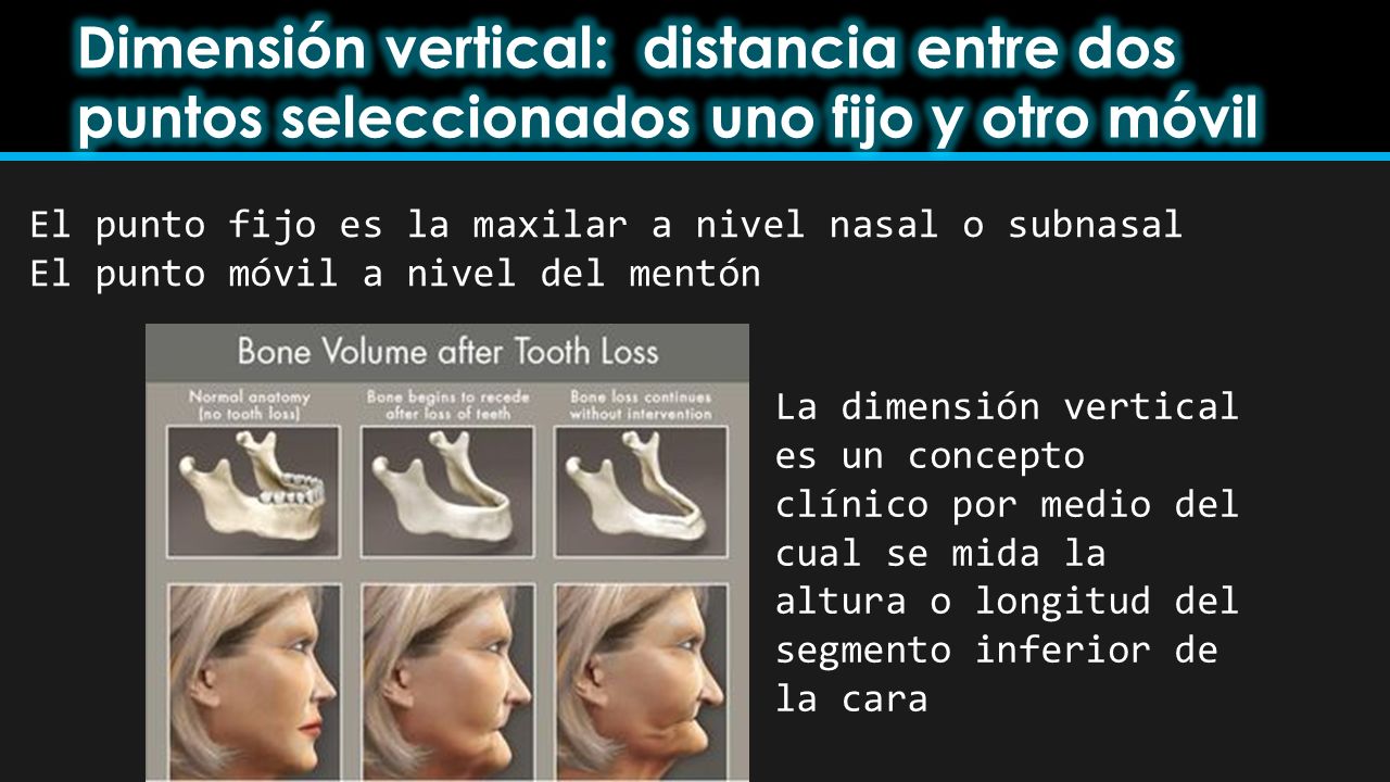 Dimensión vertical: distancia entre dos puntos seleccionados uno fijo y otro móvil