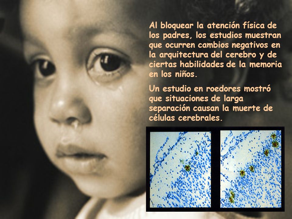 Al bloquear la atención física de los padres, los estudios muestran que ocurren cambios negativos en la arquitectura del cerebro y de ciertas habilidades de la memoria en los niños.