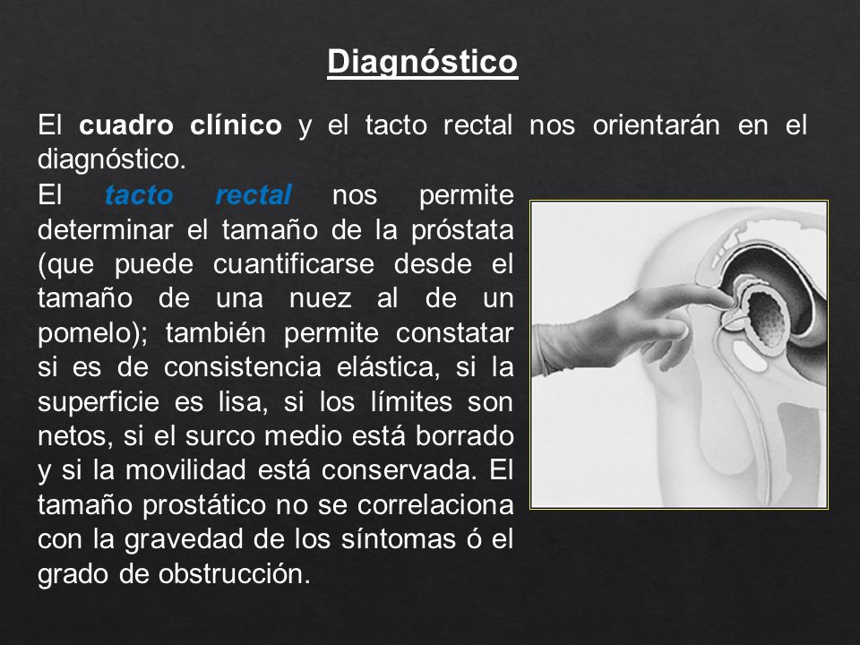 Diagnóstico El cuadro clínico y el tacto rectal nos orientarán en el diagnóstico.