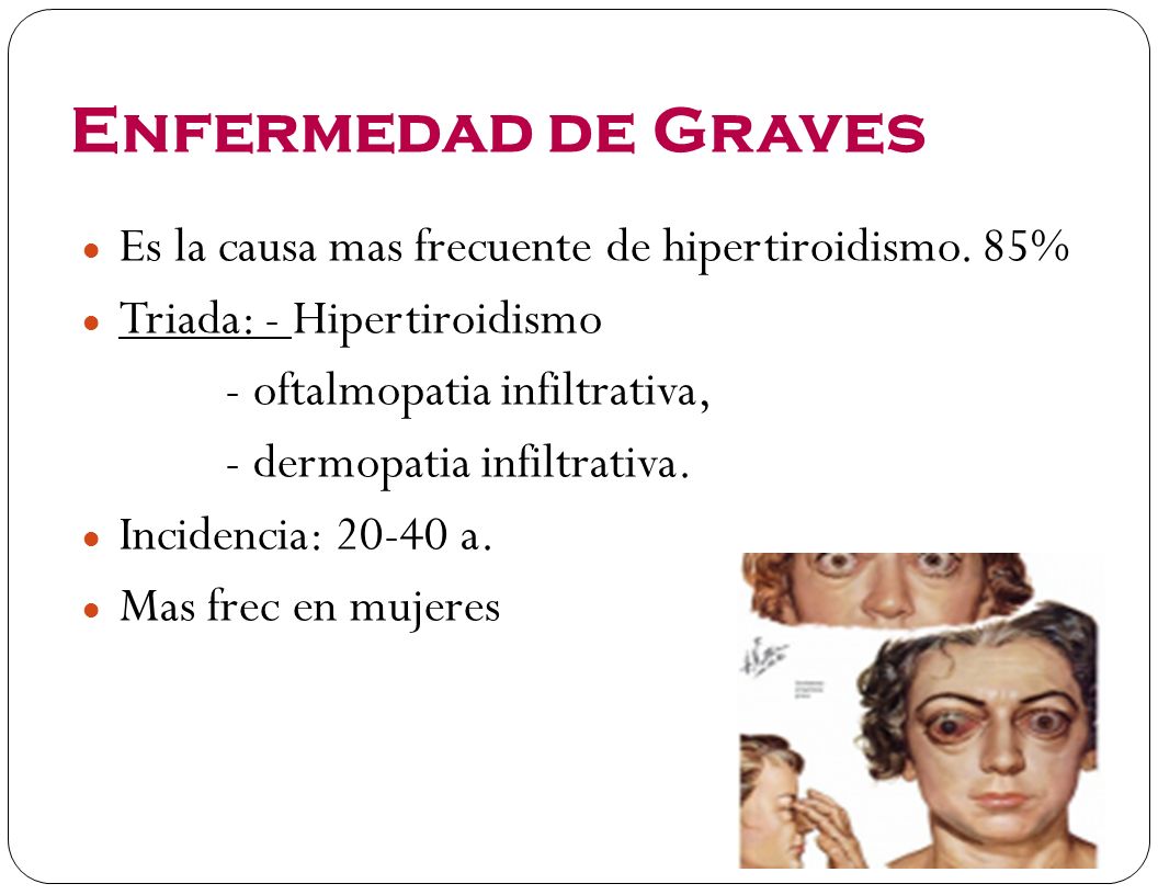 Enfermedad de Graves Es la causa mas frecuente de hipertiroidismo. 85%