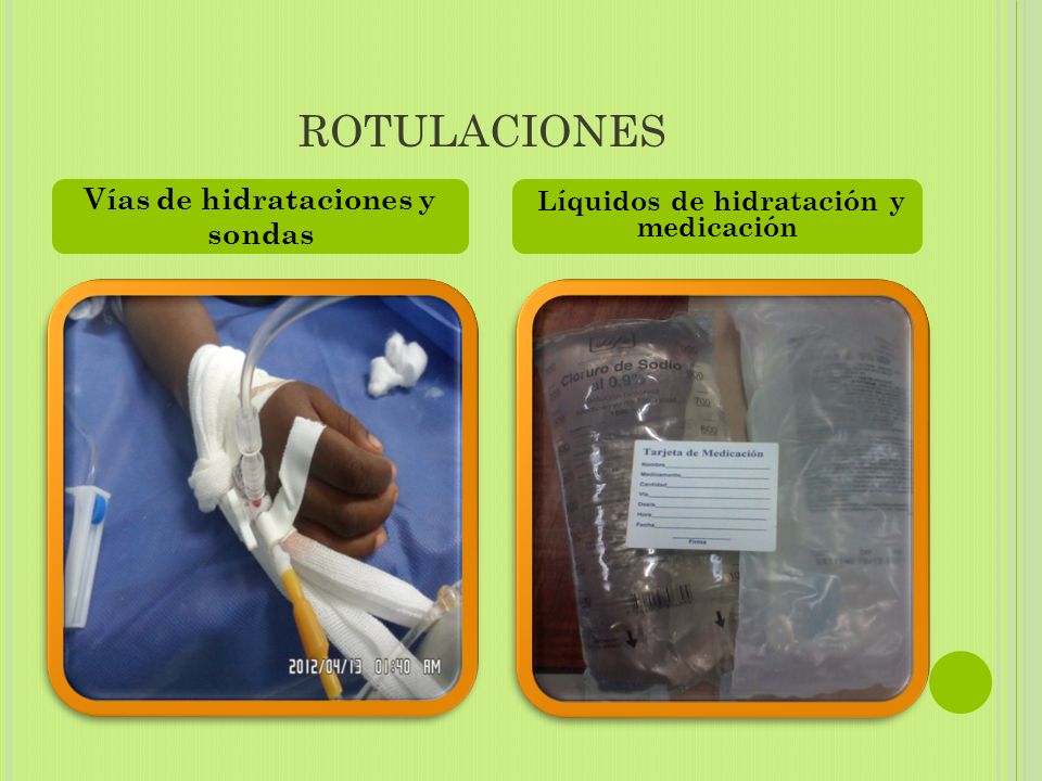 Vías de hidrataciones y sondas Líquidos de hidratación y medicación