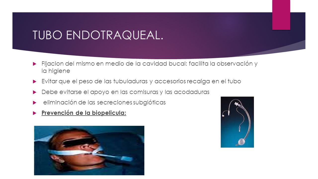 TUBO ENDOTRAQUEAL. Fijacion del mismo en medio de la cavidad bucal: facilita la observación y la higiene.