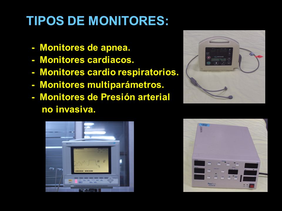 TIPOS DE MONITORES: - Monitores de apnea. - Monitores cardiacos.