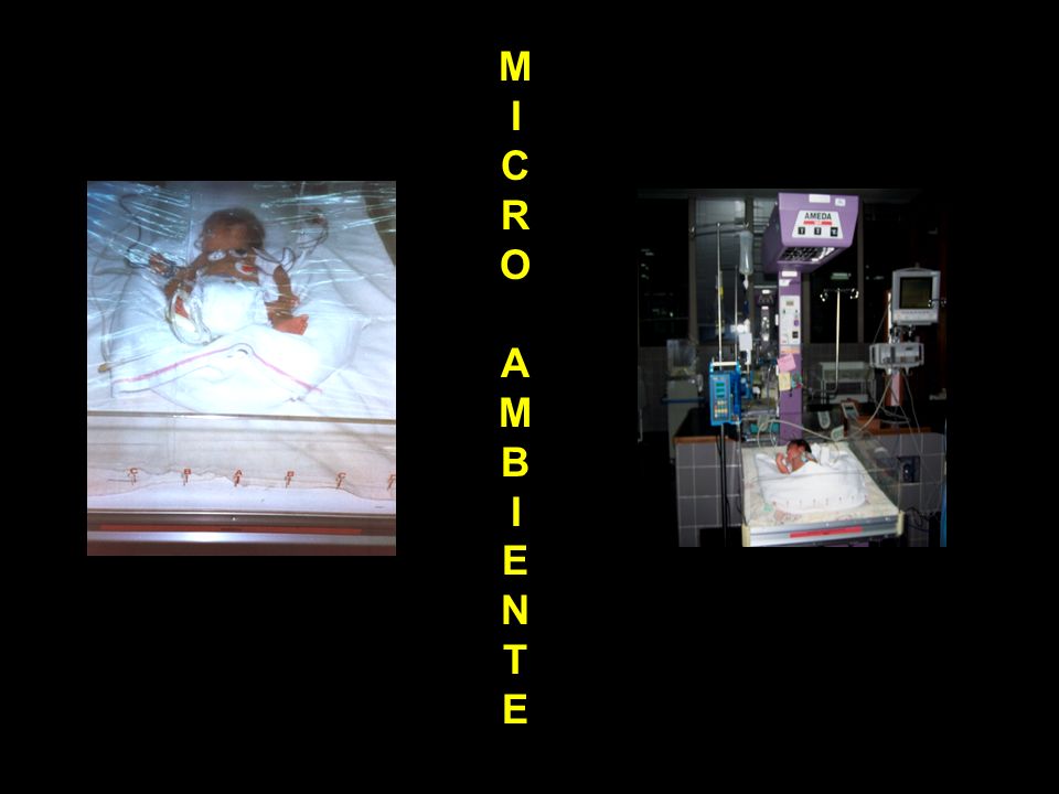 M I C R O A B E N T