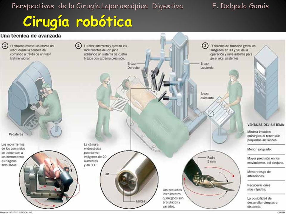 Perspectivas de la Cirugía Laparoscópica Digestiva F. Delgado Gomis