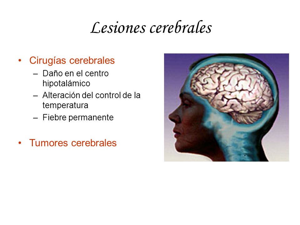 Lesiones cerebrales Cirugías cerebrales Tumores cerebrales