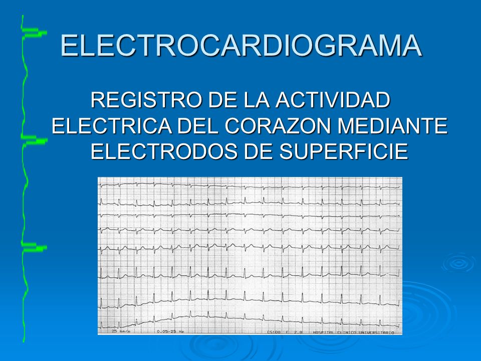 ELECTROCARDIOGRAMA REGISTRO DE LA ACTIVIDAD ELECTRICA DEL CORAZON MEDIANTE ELECTRODOS DE SUPERFICIE