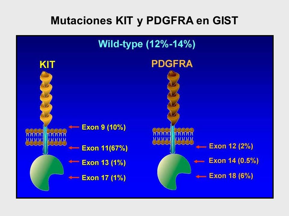 Mutaciones KIT y PDGFRA en GIST