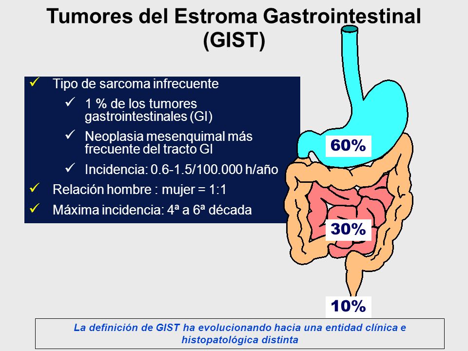Tumores del Estroma Gastrointestinal (GIST)