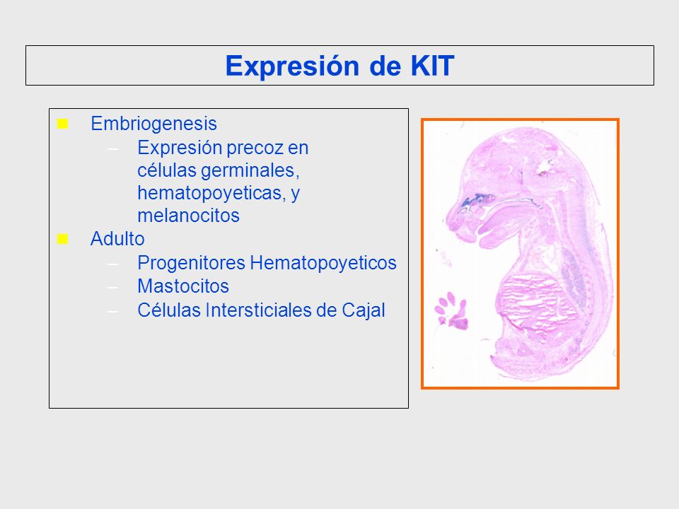 Expresión de KIT Embriogenesis
