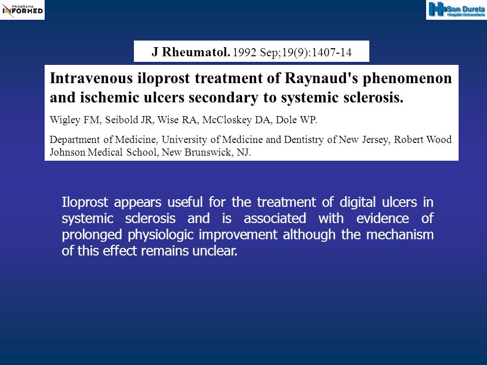 J Rheumatol Sep;19(9): Intravenous iloprost treatment of Raynaud s phenomenon and ischemic ulcers secondary to systemic sclerosis.