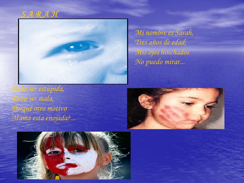 S A R A H Mi nombre es Sarah, Tres años de edad; Mis ojos hinchados No puedo mirar...