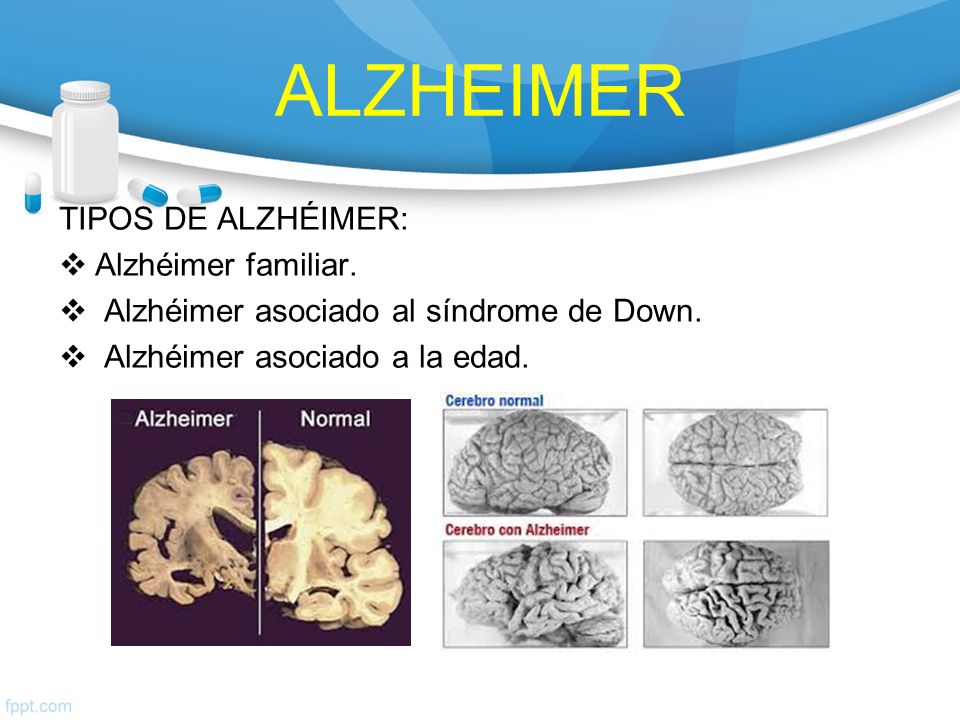 ALZHEIMER TIPOS DE ALZHÉIMER: Alzhéimer familiar.